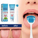🔥2023 Sale - Probiotic Tongue Cleaning Gel Set（Buy 3 Get Free Shipping) - PlanetShopper