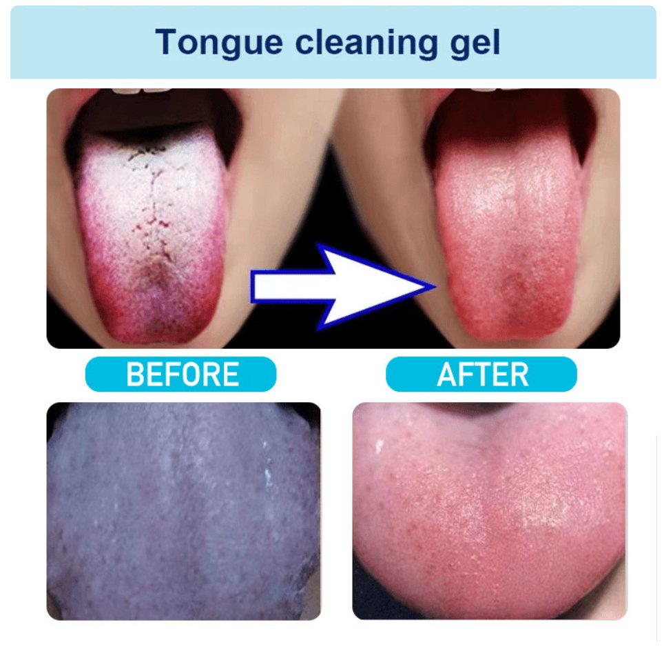 🔥2023 Sale - Probiotic Tongue Cleaning Gel Set（Buy 3 Get Free Shipping) - PlanetShopper